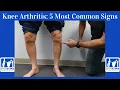 Download Lagu Knee Arthritis- 5 Most Common Signs You Have It!