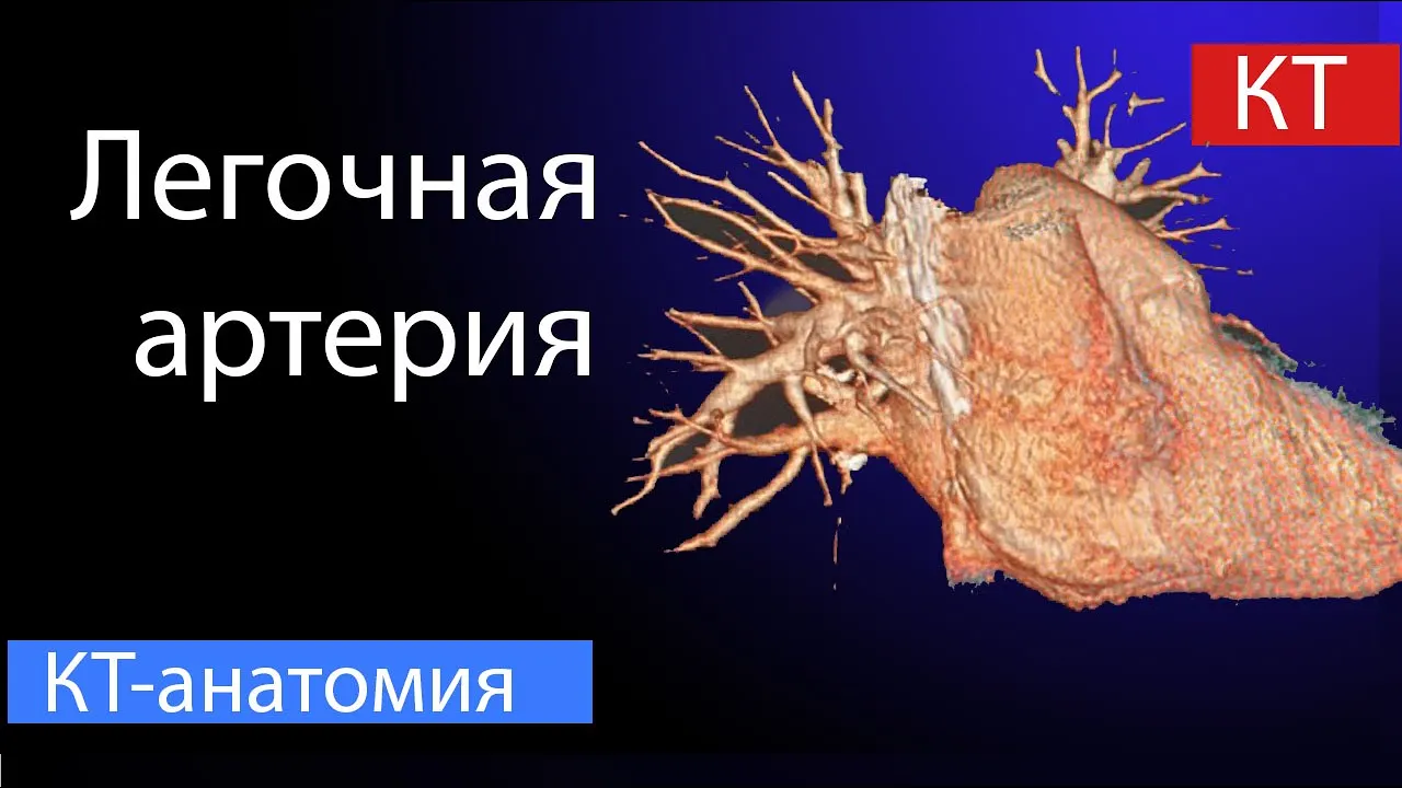 Лучевая анатомия лёгочной артерии на КТ: полный разбор