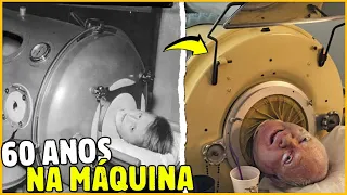 COMO ERA VIVER NO PULMÃO DE FERRO E PARA QUE SERVE?