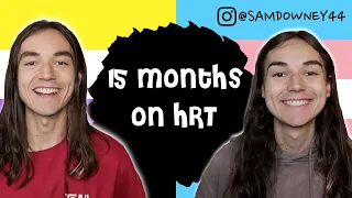 15 MONTHS ON HRT AMAB TO NON BINARY MTF