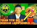 Download Lagu TEKAN TITIK INI...!!!  BENGKAK LIMPA JADI SEMBUH...!!!