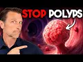 What is a Polyp The Best Food for Colon Polyp Prevention - Dr Berg