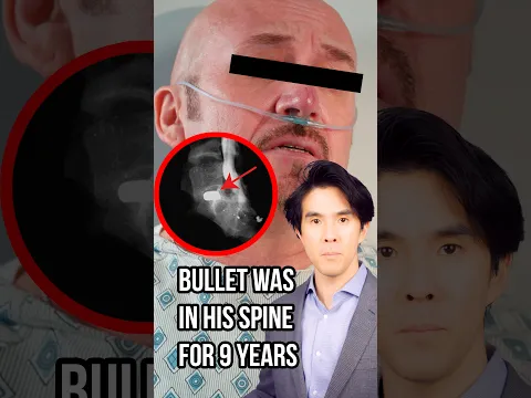 Insane Bullet In Brazilian Man's Spine 😳