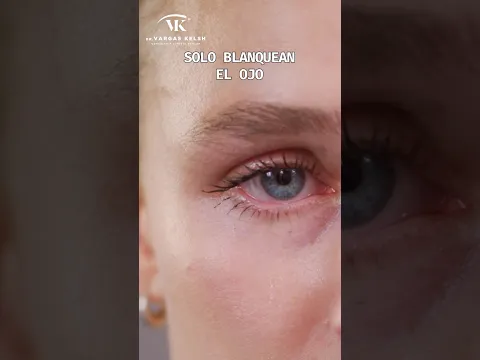 DEJA YA de usar estas Gotas para tus Ojos ⚠️