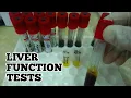 Liver Function Tests LFTs Hepatic Panel Liver Panel All details about this test in Urdu Hindi