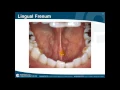 Landmarks of the oral cavity