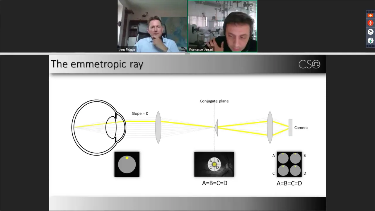 SCHWIND Peramis Principles and Applications  Webinar  Recording of 14 May 2020