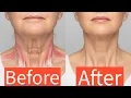 Lift Sculpt Your Neck Naturally Massage for Turkey Neck Platysma