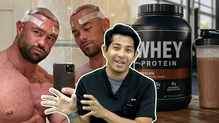 Adakah Protein dan Bina Badan Boleh Jadi Botak?
