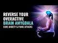 Download Lagu Reverse Your Overactive Brain Amygdala | Lessen Fear Response in Body | Cure Anxiety \u0026 Panic Attacks