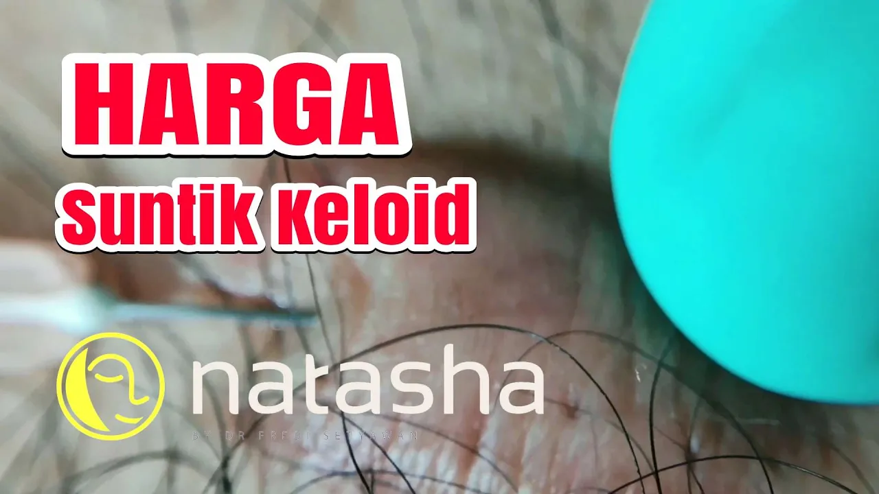 CARA MUDAH MENGHILANGKAN BEKAS LUKA DENGAN TREATMENT LASER. 