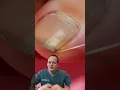 Download Lagu DOCTOR REACTS: FLOSSING YOUR TOENAILS?!😱😳