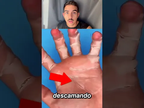 CUIDADO SE SUA PELE ESTIVER ASSIM ib: @canalinquietamente