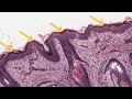 Stratified Squamous Non Keratinized and Keratinized Epithelium