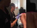 Using Sculptra to Add Volume Contour to the Buttock Butt Augmentation