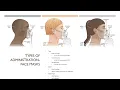 Med-Surg Mini Airway Management