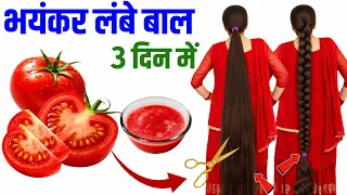 टमाटर का रस में एक चीज मिलाकर बालों में लगा लो | Bal bhayankar Lambe Ghane Ho jaenge 💯 ✅