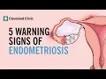 Download Lagu 5 Warning Signs of Endometriosis