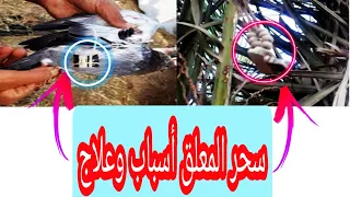 السحر المعلق كيف يصنع ولما يصنع وعلاجه 