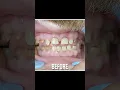 Download Lagu Smiling Free with My Instant Smile Makeover!