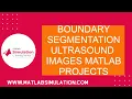 Boundary Segmentation Ultrasound Images Matlab Projects Matlab P Project Tutorials