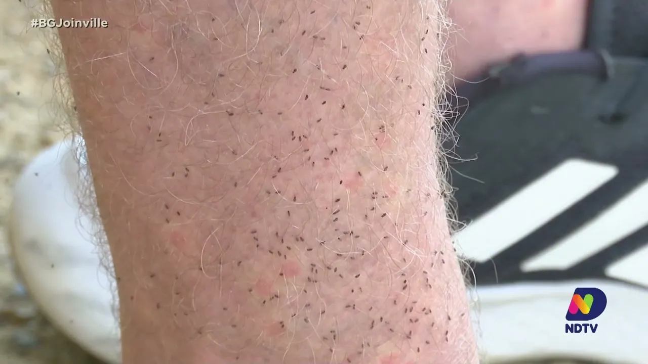 Quatro cidades da região Norte registram casos de febre do Oropouche