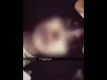 ئەم قژ لولانەیش جوانن😔😂،،