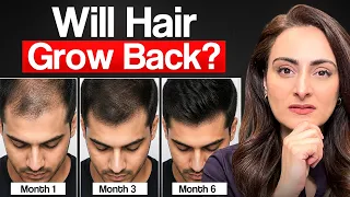 Answering most googled hair loss questions | hair oil, shampoo, serum for hair loss