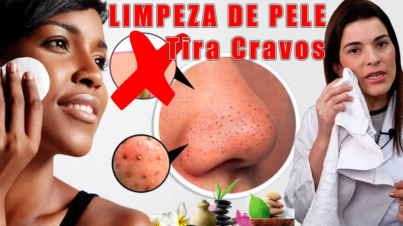 COMO TIRAR CRAVOS E ESPINHAS - LIMPEZA DE PELE SEM GASTAR NADA