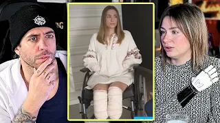 Los primeros síntomas de la bacteria que le provocaría la amputación de manos y pies | Carla Maronda