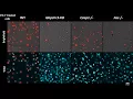 Download Lagu IFN-γ extends the immune functions of Guanylate Binding Proteins to inflammasome-independent