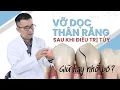 Lagu Vỡ Dọc Thân Răng Sau Điều Trị Tủy: Bảo Tồn Hay Nhổ Bỏ?