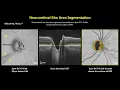 Optic nerve head microarchitecture en-face OCT and OCT angiographic imaging of lamina cribrosa