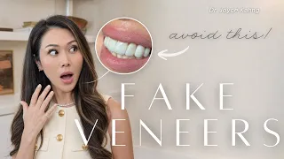 Why Some Veneers Look Fake (And Others Don’t)