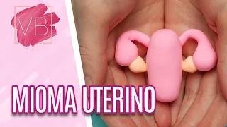 Mioma uterino: causas, sintomas e tratamentos - Você Bonita (27/01/21)