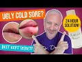 Cold Sore Cure Nail Polish Remover Remedy Dr Doug