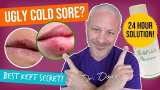 Cold Sore Cure Nail Polish Remover Remedy Dr Doug
