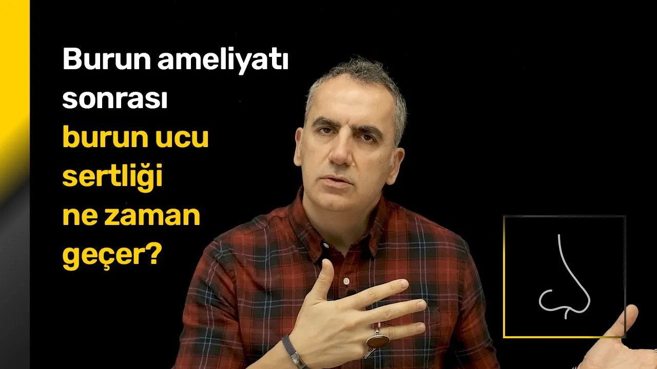 Burnum Düştü ! Burun Ameliyatım