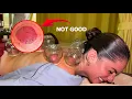 ASMR I Tried the REAL Chinese FIRE CUPPING with Tuina Massage