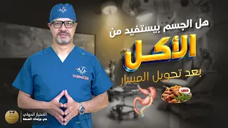 هل يستفيد الجسم بالطعام بعد عملية تحويل المسار 