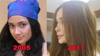 Arci Munoz Plastic Surgeries Through The Years