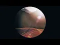 Duke Boara - Focus