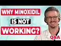 WHAT DO YOU DO IF MINOXIDIL DOES NOT WORK FOR YOU