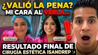Isandrep se hizo una cirugía estética se tuneó 😍