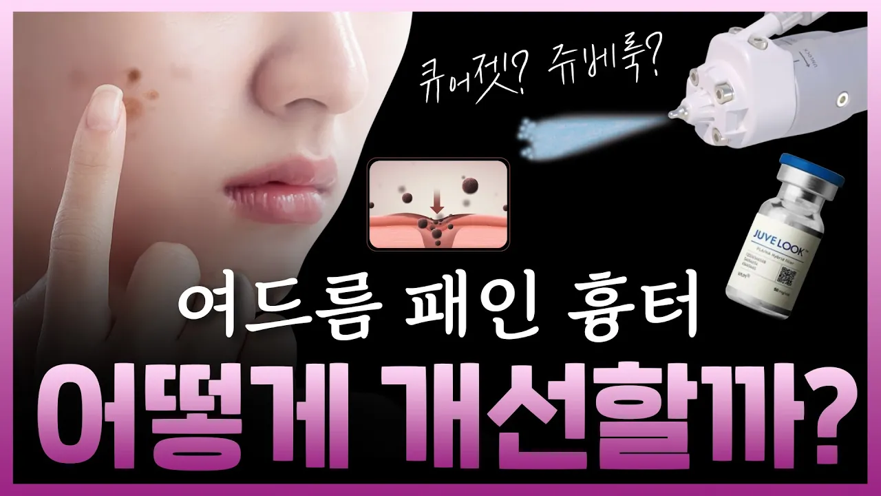여드름 패인흉터 개선, 쥬베룩 볼륨 리쥬란 빠르고 덜 아프게 하는 법! #큐어젯 #피부관리 #피부좋아지는법 #흉터치료