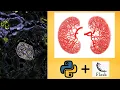 Kidney Dataset Visualisation