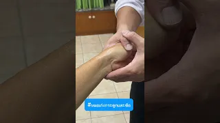  อาการเจ็บที่นิ้วหัวแม่มือมีสาเหตุมาจากอะไรบ้าง 