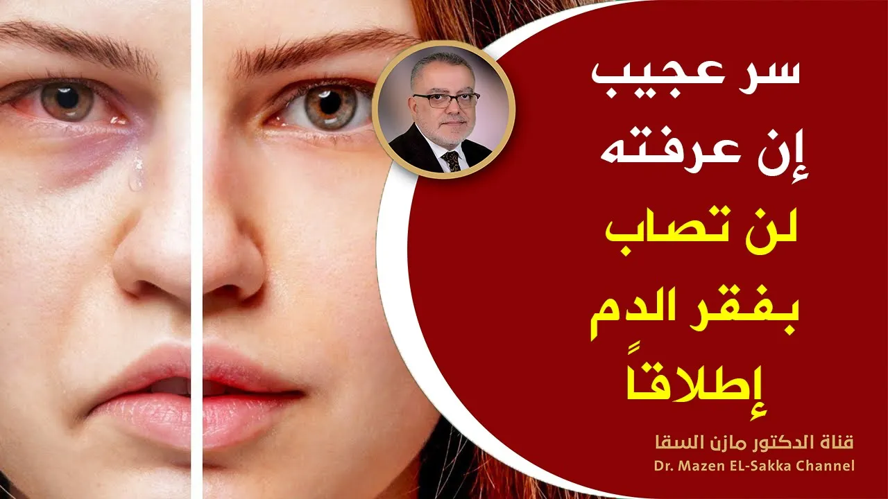 مرجع شامل لديدان فتحة الشرج مترجم الى الانجليزية والفرنسية https://youtu.be/JWI_j4hMwq8 علاج الحكة و. 