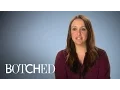 Wanting Angelina Jolie s Lips Goes Bad for Woman Botched E