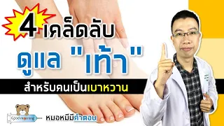 รองเท้าและถุงเท้าที่เหมาะสมสำหรับผู้ป่วยเบาหวานควรมีลักษณะอย่างไร